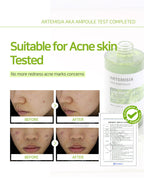 Dr. Sante Artemisia AKA Ampoule – Korean Intensive acne-prone skin, Soothing & Pore-Refining Serum with 67% Artemisia Extract, LHA-SOL™, Niacinamide & Hyaluronic Acid